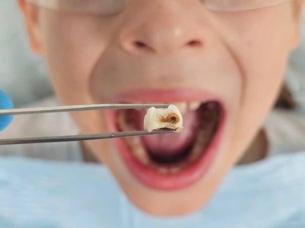 Best Emergency Cosmetic Dentistry in Laurens, SC